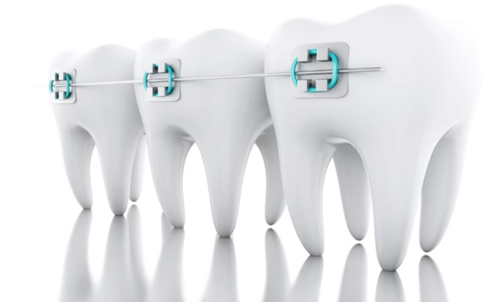Ten Genius Marketing Ideas For Orthodontists To Get New Patients