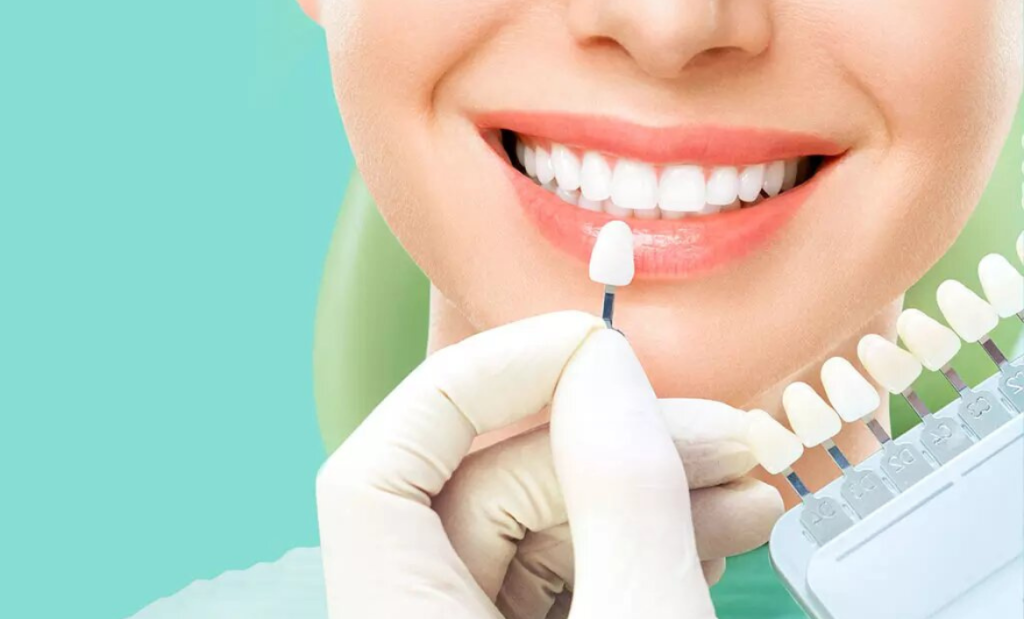 Genius Marketing Strategies For Your Teeth Whitening Service
