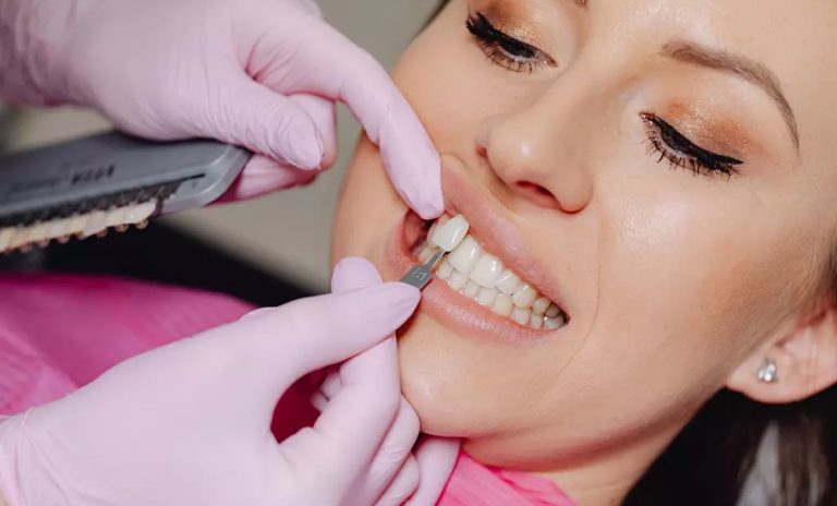 Marketing Dentistry To Women: Strategies That Are Worth Trying